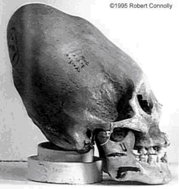 Странные черепа