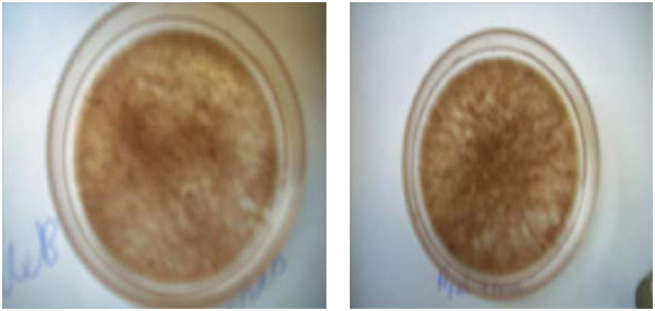 Распределение сапрофитных бактерий по дну чашки Петри