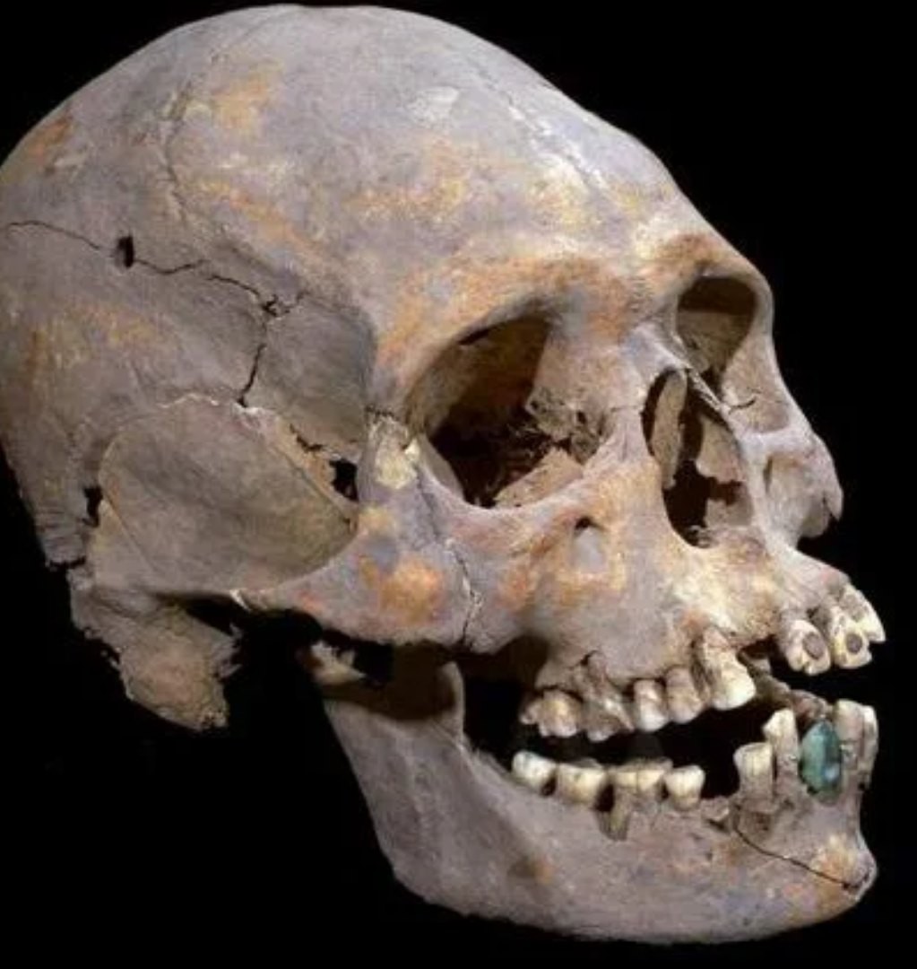 Древний череп с протезами