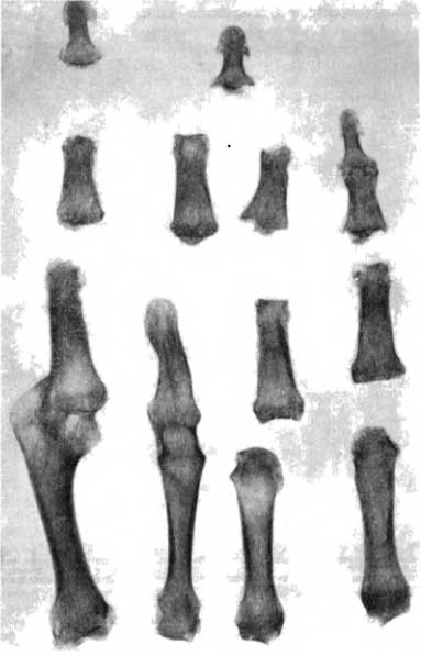 кости древних людей